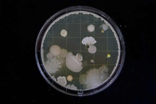 
    Mýtus o bakteriích
  